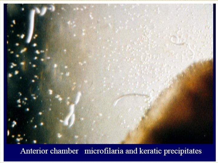 27/04/08 Dr Ekta, Microbiology 