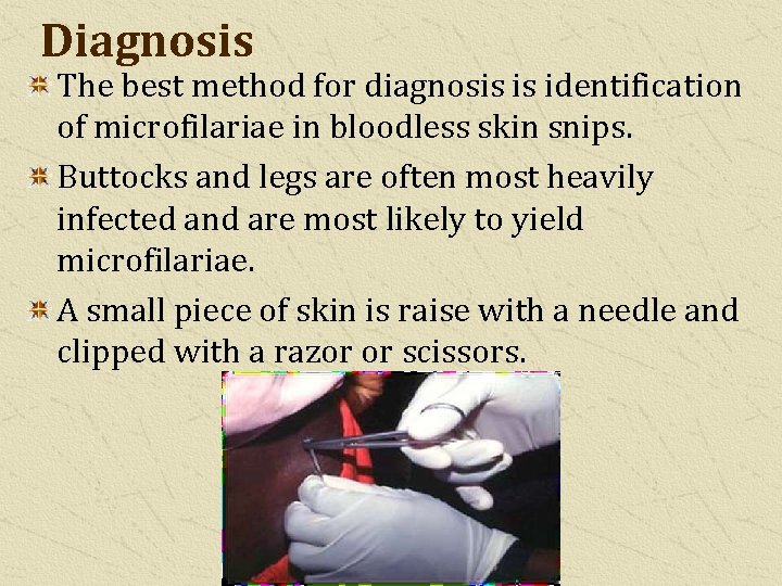 Diagnosis The best method for diagnosis is identification of microfilariae in bloodless skin snips.