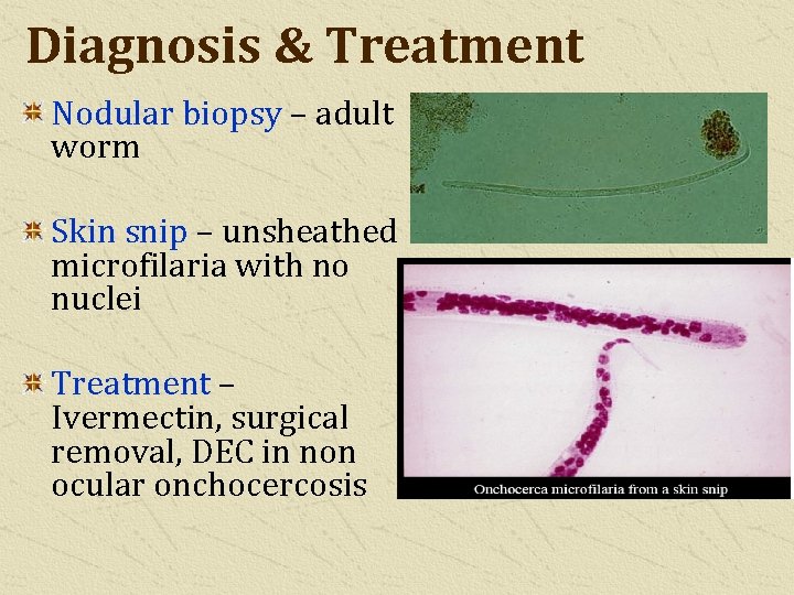 Diagnosis & Treatment Nodular biopsy – adult worm Skin snip – unsheathed microfilaria with