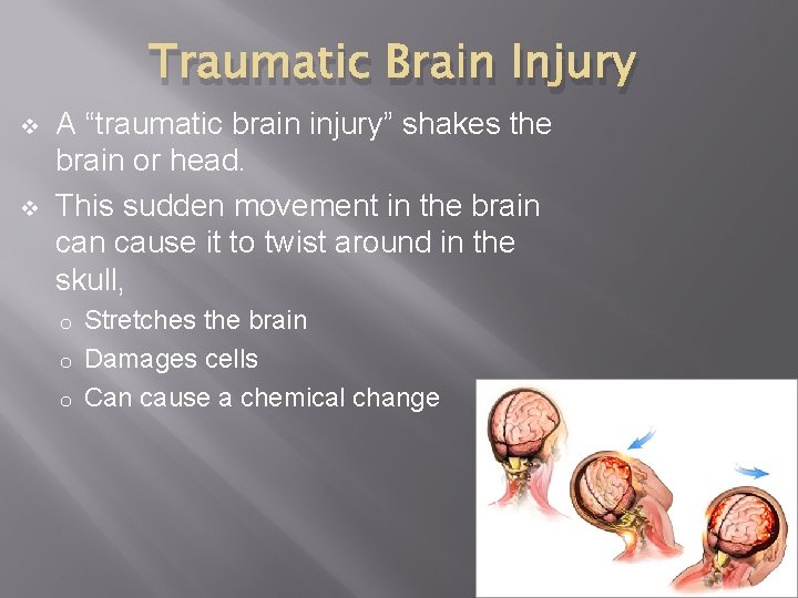 Traumatic Brain Injury v v A “traumatic brain injury” shakes the brain or head.