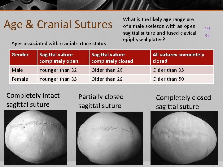 Age & Cranial Sutures Ages associated with cranial suture status What is the likely