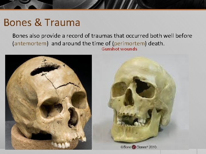 Bones & Trauma Bones also provide a record of traumas that occurred both well
