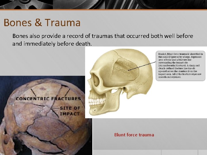 Bones & Trauma Bones also provide a record of traumas that occurred both well