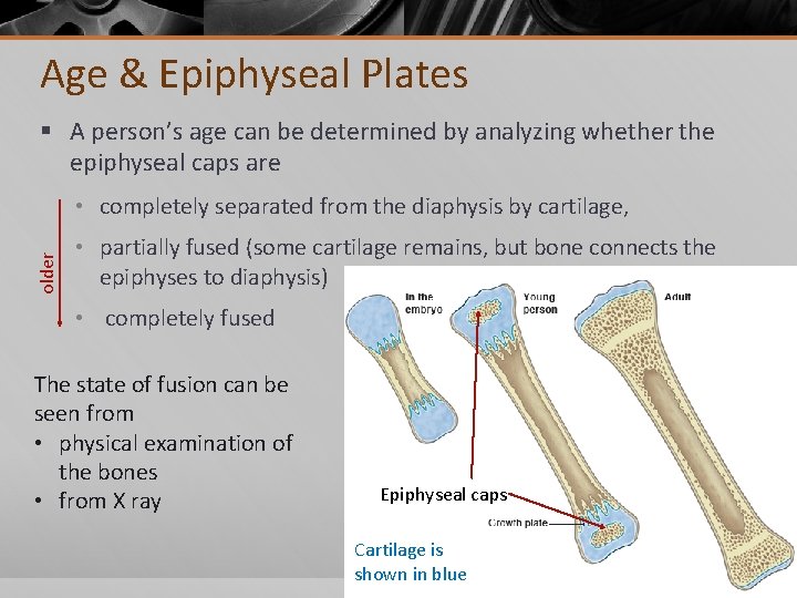 Age & Epiphyseal Plates § A person’s age can be determined by analyzing whether
