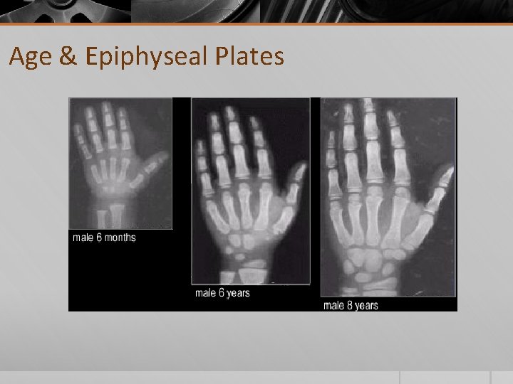 Age & Epiphyseal Plates 