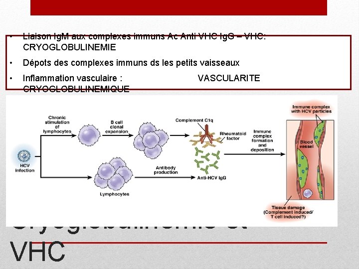  • Liaison Ig. M aux complexes immuns Ac Anti VHC Ig. G –