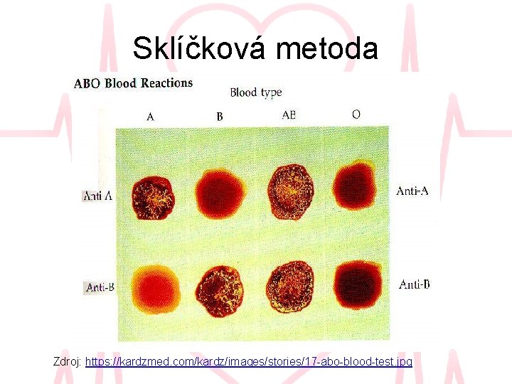 Sklíčková metoda Zdroj: https: //kardzmed. com/kardz/images/stories/17 -abo-blood-test. jpg 