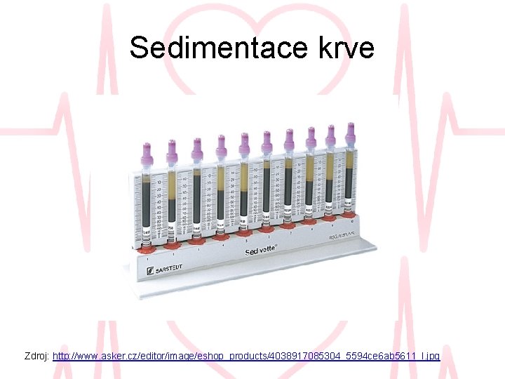 Sedimentace krve Zdroj: http: //www. asker. cz/editor/image/eshop_products/4038917085304_5594 ce 6 ab 5611_l. jpg 