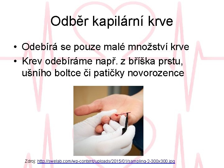 Odběr kapilární krve • Odebírá se pouze malé množství krve • Krev odebíráme např.