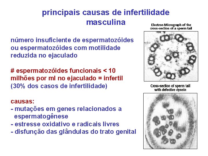 principais causas de infertilidade masculina número insuficiente de espermatozóides ou espermatozóides com motilidade reduzida