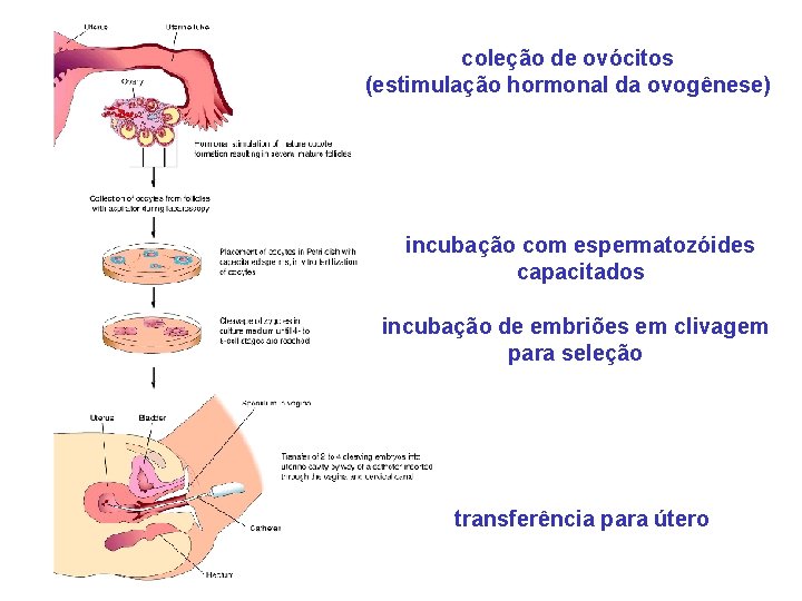 coleção de ovócitos (estimulação hormonal da ovogênese) incubação com espermatozóides capacitados incubação de embriões