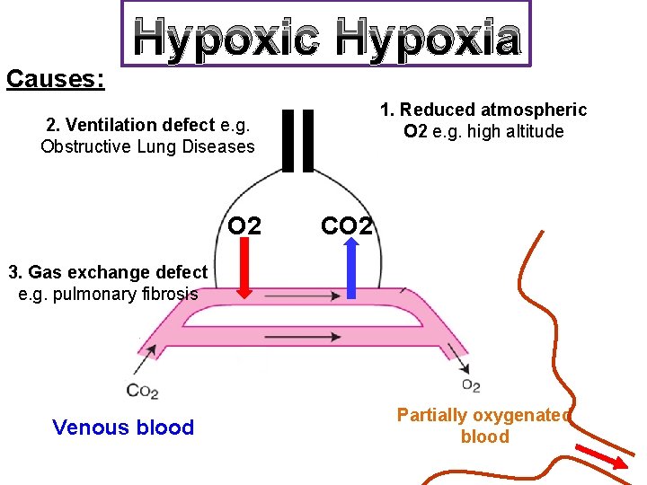 Hypoxic Hypoxia Causes: 1. Reduced atmospheric O 2 e. g. high altitude 2. Ventilation