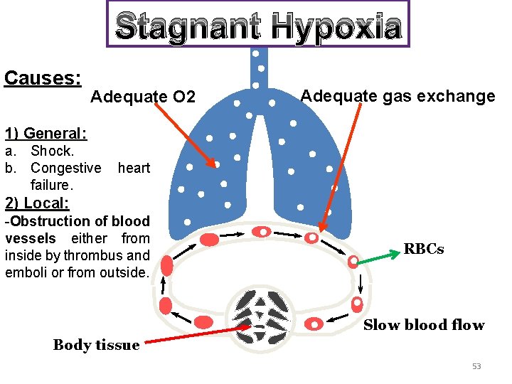 Stagnant Hypoxia Causes: Adequate O 2 Adequate gas exchange 1) General: a. Shock. b.