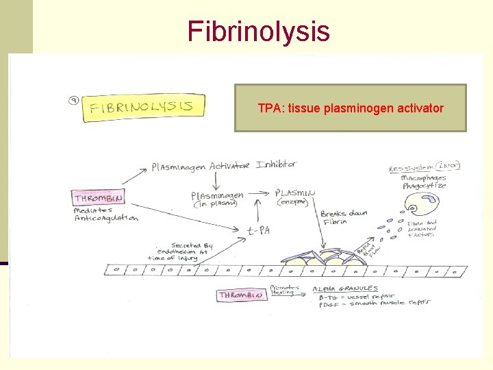 Fibrinolysis TPA: tissue plasminogen activator 