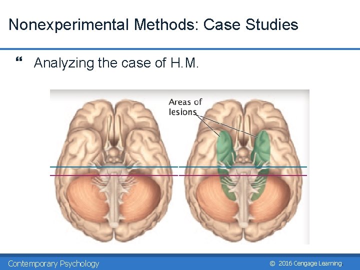 Nonexperimental Methods: Case Studies } Analyzing the case of H. M. Contemporary Psychology ©