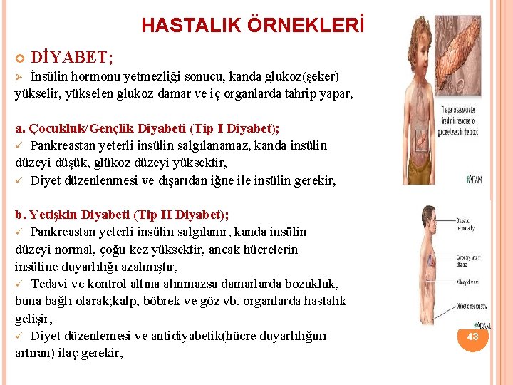 HASTALIK ÖRNEKLERİ DİYABET; İnsülin hormonu yetmezliği sonucu, kanda glukoz(şeker) yükselir, yükselen glukoz damar ve