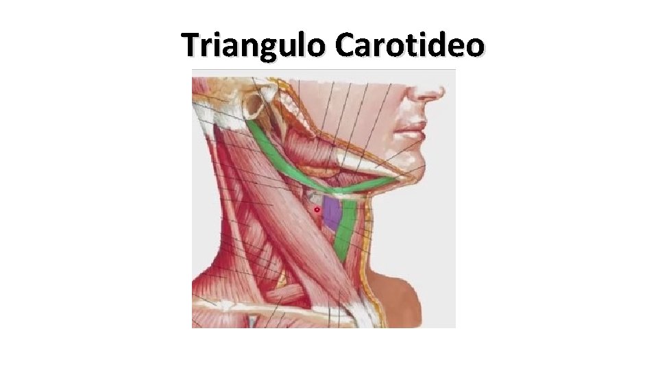 Triangulo Carotideo 