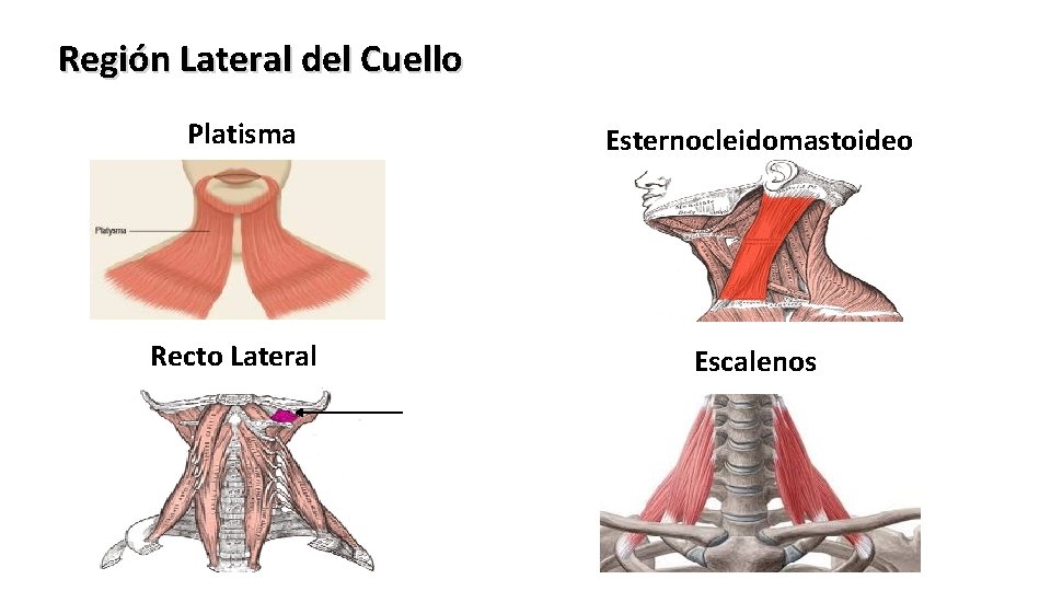 Región Lateral del Cuello Platisma Esternocleidomastoideo Recto Lateral Escalenos 