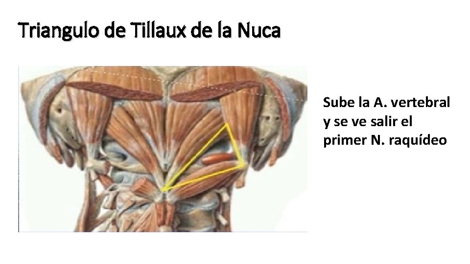 Triangulo de Tillaux de la Nuca Sube la A. vertebral y se ve salir