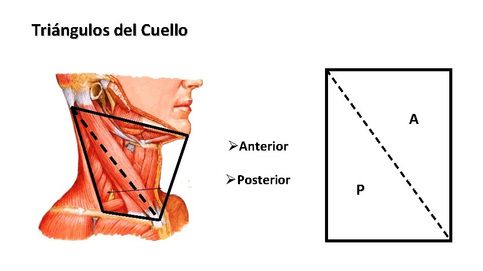 Triángulos del Cuello A ØAnterior ØPosterior P 