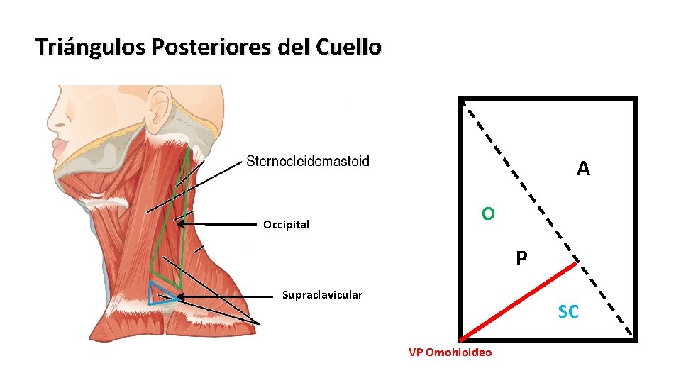 Triángulos Posteriores del Cuello A Occipital O P Supraclavicular SC VP Omohioideo 