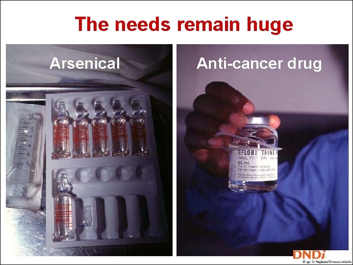 The needs remain huge Arsenical Anti-cancer drug 