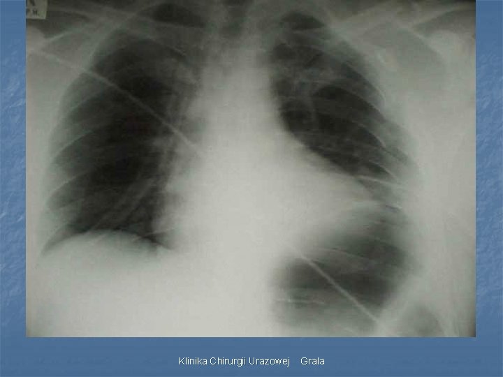Klinika Chirurgii Urazowej Grala 