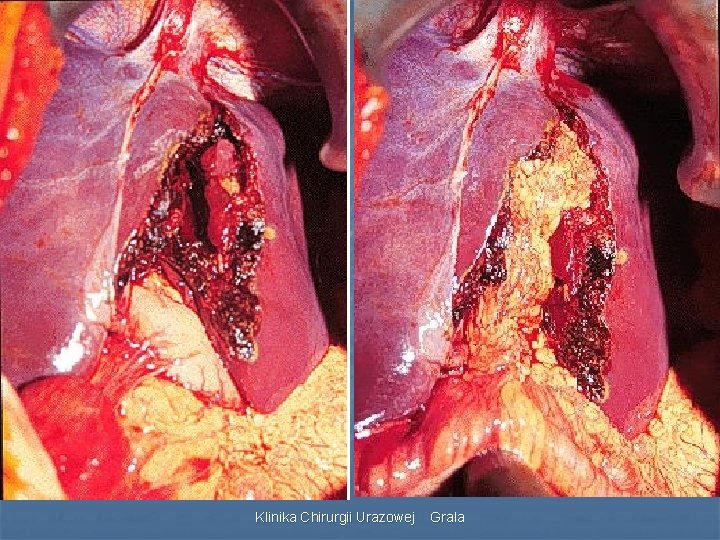 Klinika Chirurgii Urazowej Grala 