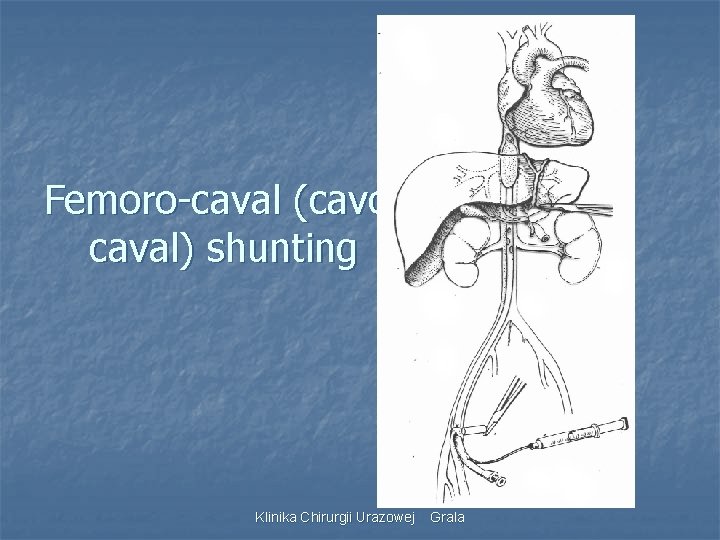 Femoro-caval (cavocaval) shunting Klinika Chirurgii Urazowej Grala 