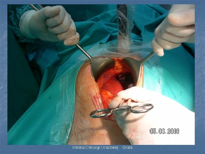 Klinika Chirurgii Urazowej Grala 
