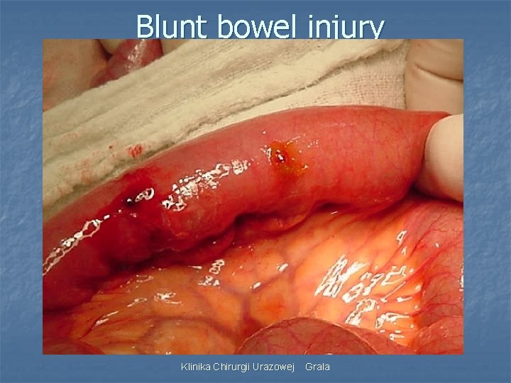 Blunt bowel injury Klinika Chirurgii Urazowej Grala 