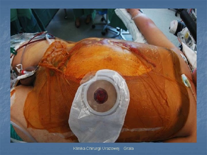 Klinika Chirurgii Urazowej Grala 