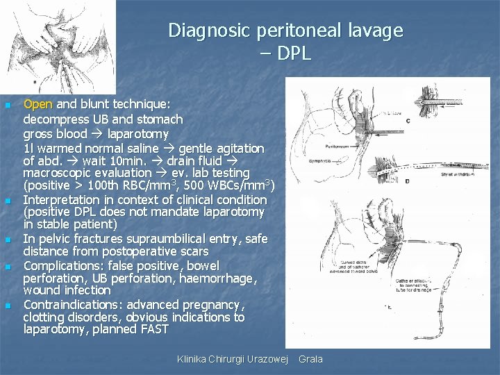Diagnosic peritoneal lavage – DPL n n n Open and blunt technique: decompress UB