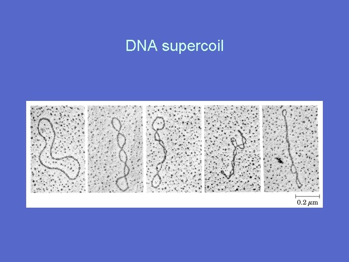 DNA supercoil 