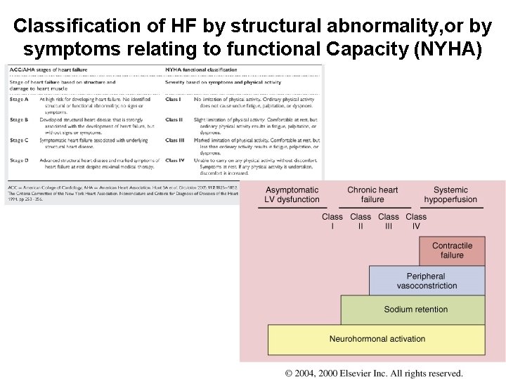 Classification of HF by structural abnormality, or by symptoms relating to functional Capacity (NYHA)