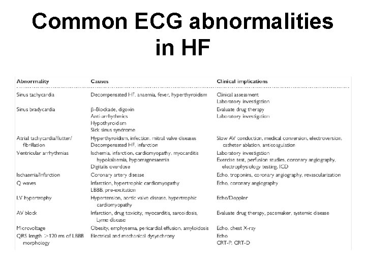 Common ECG abnormalities in HF 