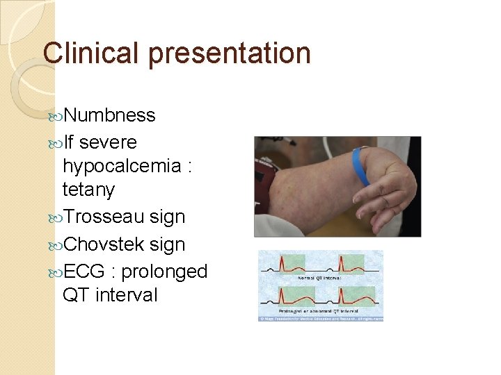 Clinical presentation Numbness If severe hypocalcemia : tetany Trosseau sign Chovstek sign ECG :