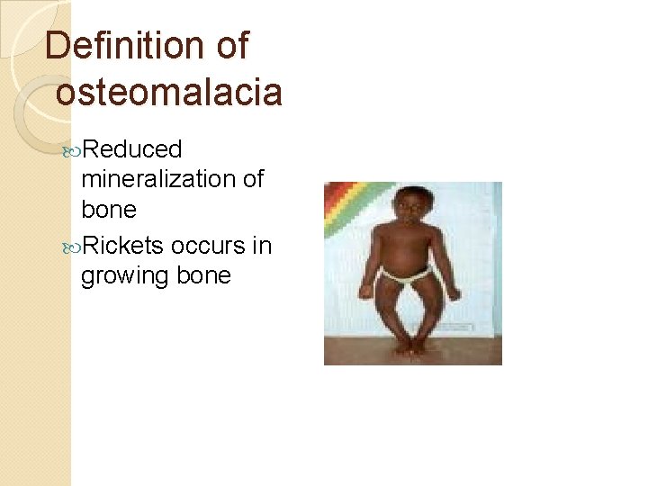 Definition of osteomalacia Reduced mineralization of bone Rickets occurs in growing bone 