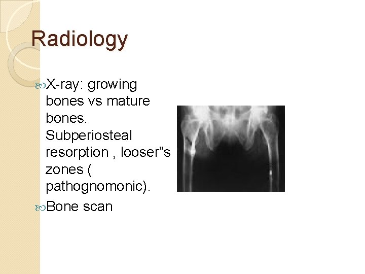 Radiology X-ray: growing bones vs mature bones. Subperiosteal resorption , looser”s zones ( pathognomonic).