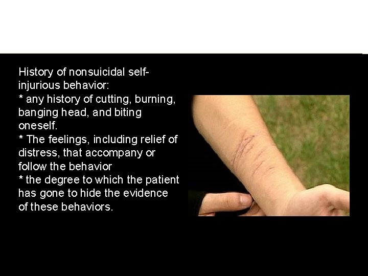 History of nonsuicidal selfinjurious behavior: * any history of cutting, burning, banging head, and