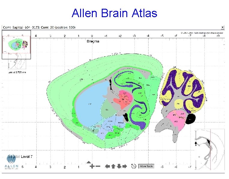 Allen Brain Atlas 