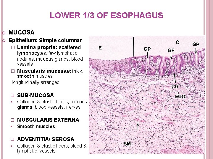 LOWER 1/3 OF ESOPHAGUS MUCOSA Epithelium: Simple columnar � Lamina propria: scattered lymphocytes, few LOWER 1/3 OF ESOPHAGUS MUCOSA Epithelium: Simple columnar � Lamina propria: scattered lymphocytes, few