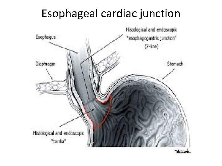 Esophageal cardiac junction Esophageal cardiac junction
