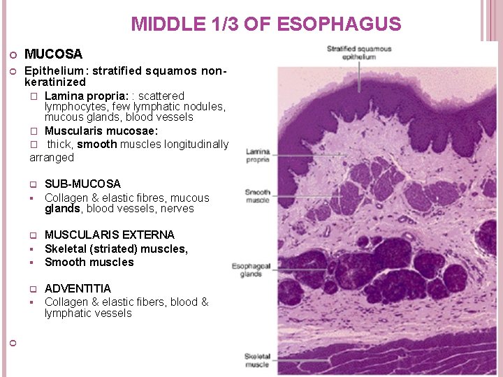 MIDDLE 1/3 OF ESOPHAGUS MUCOSA Epithelium: stratified squamos nonkeratinized Lamina propria: : scattered lymphocytes, MIDDLE 1/3 OF ESOPHAGUS MUCOSA Epithelium: stratified squamos nonkeratinized Lamina propria: : scattered lymphocytes,