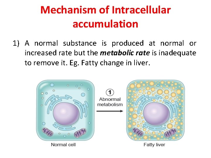 Mechanism of Intracellular accumulation 1) A normal substance is produced at normal or increased
