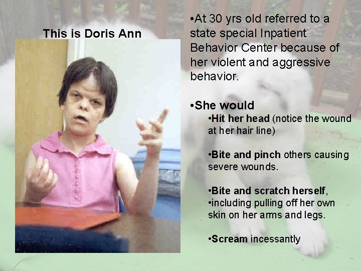This is Doris Ann • At 30 yrs old referred to a state special