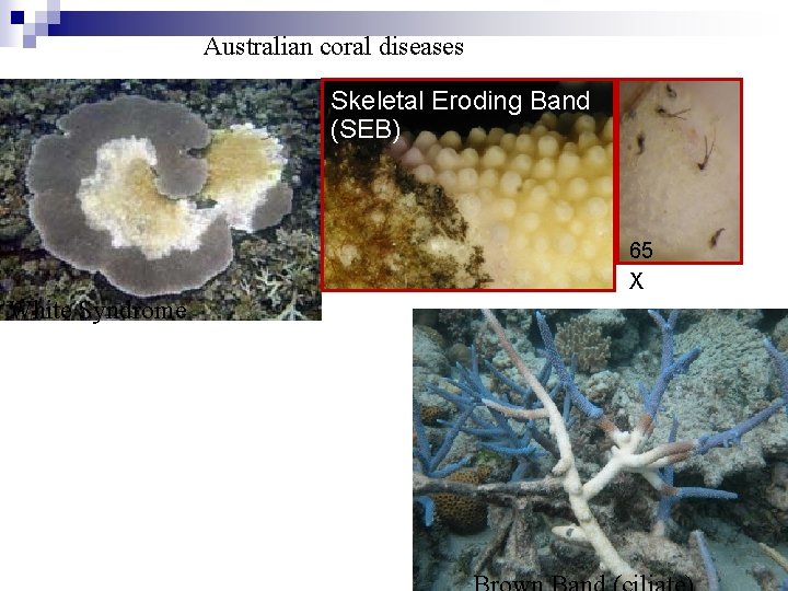 Australian coral diseases Skeletal Eroding Band (SEB) 65 X White Syndrome 