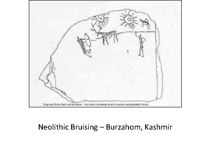 Neolithic Bruising – Burzahom, Kashmir 
