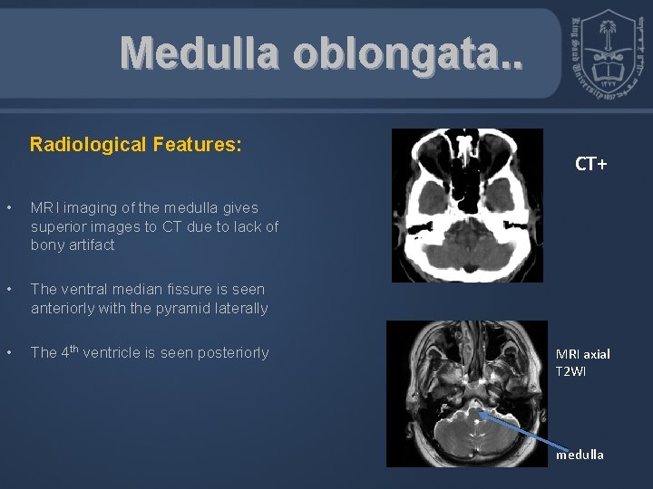 Medulla oblongata. . Radiological Features: • MRI imaging of the medulla gives superior images