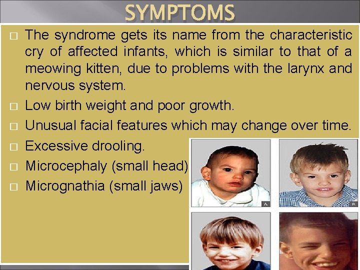 � � � SYMPTOMS The syndrome gets its name from the characteristic cry of